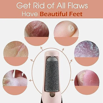 Electric Callus Remover